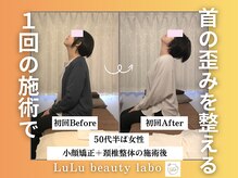 ルルラボ(LuLu beauty labo)/首こり姿勢崩れを改善