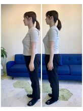 きりん接骨鍼灸院 尼崎武庫之荘店/姿勢指導