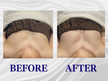 ザモア 福岡天神(THE MORE)/【症例 Before After】