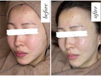 ベルーテ 田町三田(Bellute)/パッと見て美しい肌へ♪