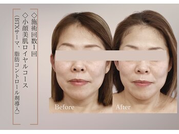 ベラ 東京院(Bella)/美容意識が高い方に選ばれてます