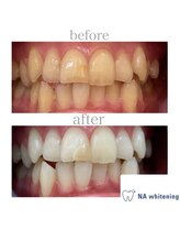 エヌエーホワイトニング たまプラーザ店(NAホワイトニング)/セルフホワイトニングたまプラ