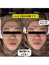 チョアチョア 札幌すすきの店(CHOA-CHOA)/男性にも大人気のコルギ♪