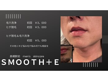 スムース イー(Smooth+E)の写真/【メンズ特化】高槻都度で都度払いヒゲ脱毛＆毛穴洗浄やニキビケアのできるサロン。メンズも清潔感UP☆
