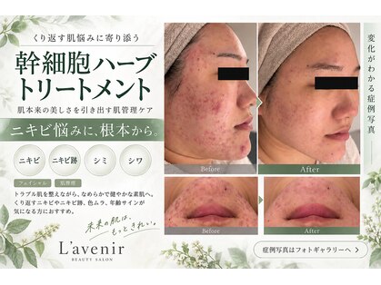 ラヴニール(L'avenir)の写真