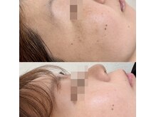 レヴィア(Revia)の雰囲気(化粧で隠しきれないシミにアプローチした肌ケア)