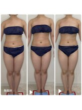 カプリス(CAPRiCE)/リンパドレナージュ