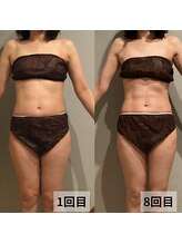 セイリキ(SEIRIKI)/★痩身ダイエットお客様のお声★