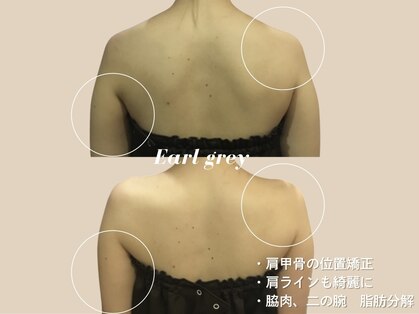 エステティックサロン アールグレーの写真