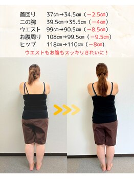 ウィータ とうの鍼灸整骨院(vita)/ダイエット