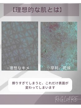 リグレア 浦安(Re.GLARE)/肌チェック