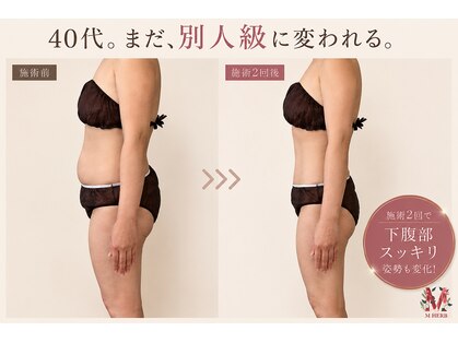 エムハーブ 君津店(M HERB)の写真