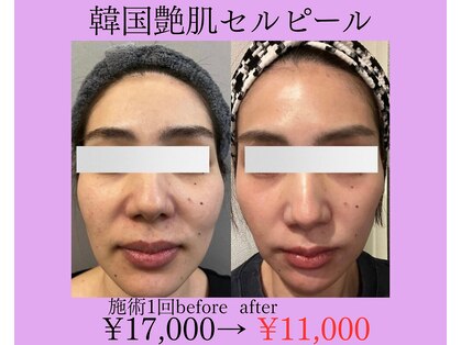 アルルプラス 南草津(ARuru+)の写真