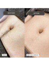 グランズ 芦屋(GLANZ)/Before→After