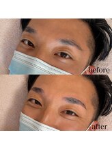 ダリ(Dali)/メンズハリウッドブロウリフト