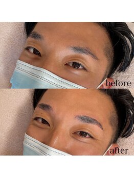 ダリ(Dali)/メンズハリウッドブロウリフト