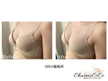 シャルムココ 蔵前店(CharmeCoCo)/お客様Before→After