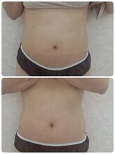 フェリームー(feerie mu)/【集中シェイプ】