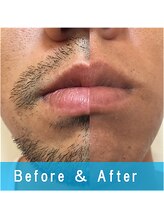 メンズサロンゼロ(Men's Salon .ZERO)/