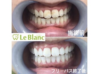 ルブラン 奈良店(Le Blanc)/黄ばみ取れます!!