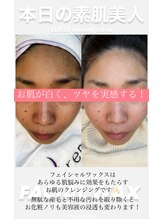 エリス(ELISSE)/お肌が白く、ツヤを実感する！