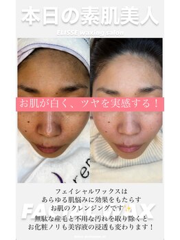 エリス(ELISSE)/お肌が白く、ツヤを実感する！