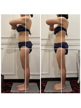 心斎橋 ルヴィ(REVI)/脚太もも/下半身/痩身ダイエット