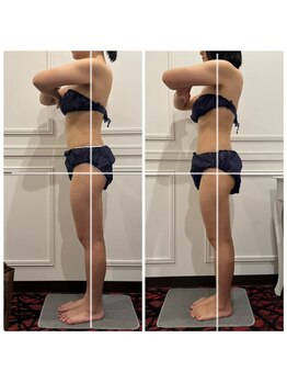 心斎橋 ルヴィ(REVI)/脚太もも/下半身/痩身ダイエット