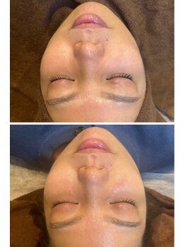 エムアイ 六本木(Mi)/ムルトックス