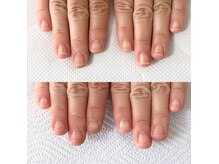 クエリード(Querido)の雰囲気（自爪育成コース/ピンクの部分が縦長に成長中）