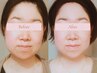 【食いしばり・エラ張り】四角い顔を理想の小顔へ◎整顔ヘッド60分￥8800→