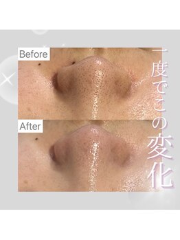 ホワイトラボ 姫路(White labo)/韓国肌管理専門店White labo姫路