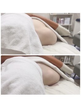 リシア(RECIA)/肩