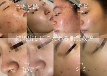 アテ 国分寺店(Ate)