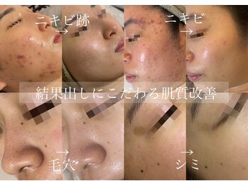 アテ 国分寺店(Ate)