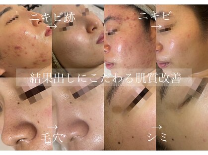 アテ 国分寺店(Ate)の写真