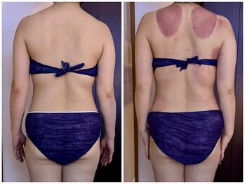 イーリバイブ/iNVYDOM MAX