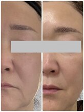 ピーナップ(P-nap)/６０代