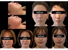 トロワ(TROIS)の雰囲気（たるみ改善から美肌まで幅広く対応。看護師目線での技術提供！）