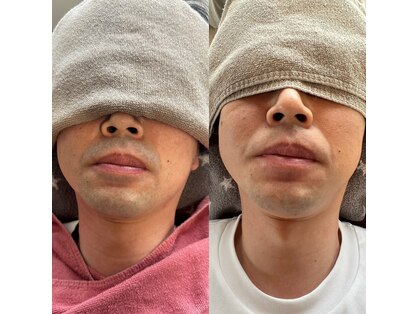 フェリーチャ(Felicha)の写真