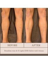 ルディ 阿波座店(rudi)/脚ALL　ワックス＆SHR光脱毛