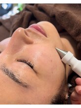 パシテア(Pasithea)/メソポレーション