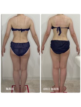 カプリス(CAPRiCE)/リンパドレナージュ