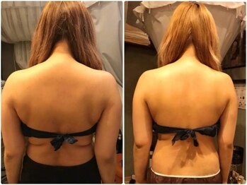 ティアス(t-us)/【痩身】キャビテーション