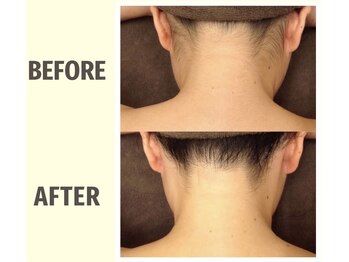 美ボディメイク 柏店(美BODYメイク)/おすすめ☆うなじ脱毛