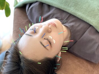 カイズ 日本橋人形町(KAIZ)/女性大人気の”美容鍼”