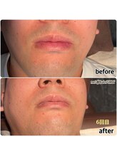 シンバ 倉敷店(SIMBA)/