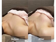 チエミ(Chi e mi)/ふっくら上向き★ボンボンバスト