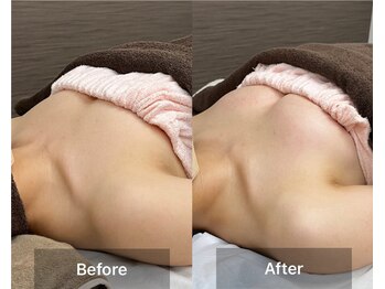 チエミ(Chi e mi)/ふっくら上向き★ボンボンバスト