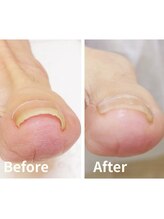 リゼラアンドコー 宇都宮陽南店/ドイツ式フットケア専門店